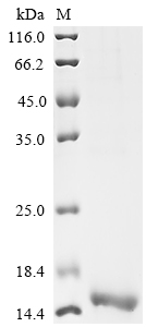 SDS-PAGE