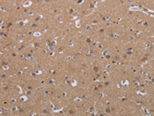 Валидация AssayVector ARM1874(2524)