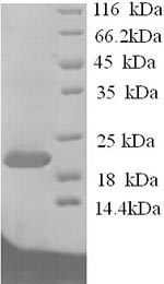 SDS-PAGE