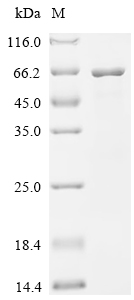 SDS-PAGE