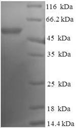 SDS-PAGE