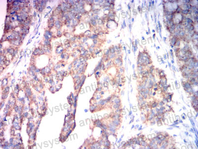 Валидация AntibodySystem RHD01402