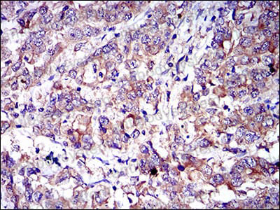 Валидация AntibodySystem RHD87602