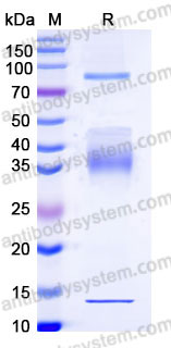 EHB91607, SDS-PAGE