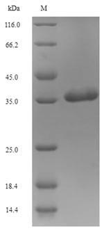 SDS-PAGE