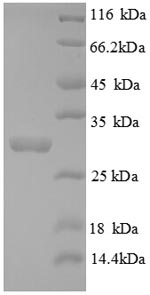 SDS-PAGE