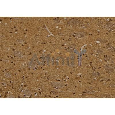 Валидация Affinity DF6112 - 17329