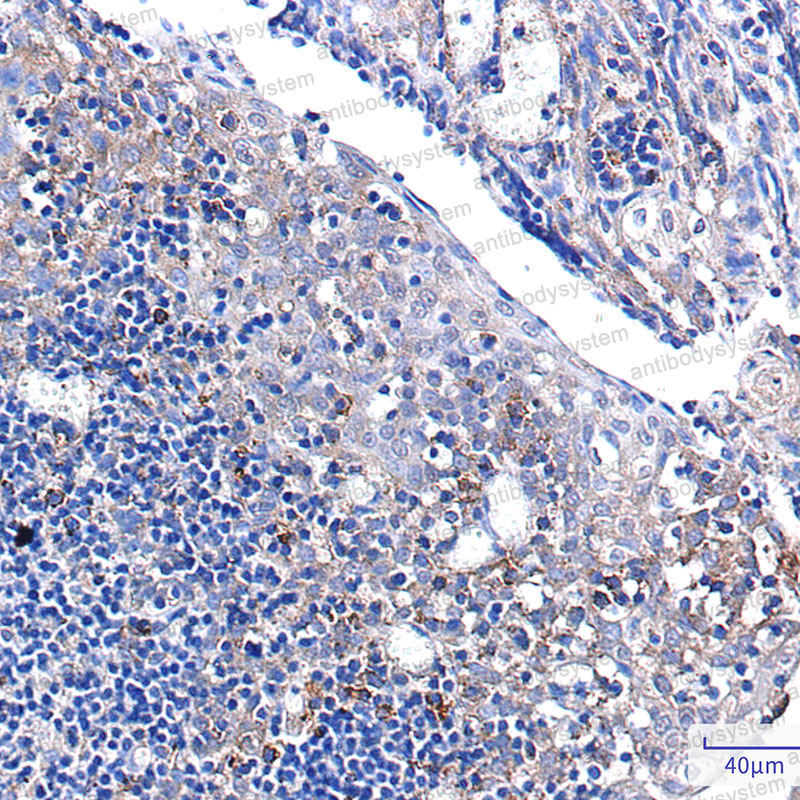 Валидация AntibodySystem RHG86201