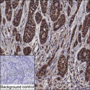 Валидация AntibodySystem RHD88301