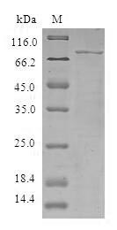 SDS-PAGE