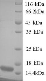 SDS-PAGE
