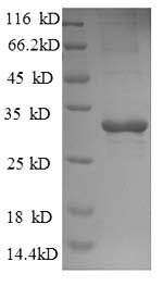 SDS-PAGE