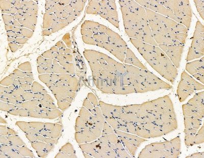 Валидация Affinity DF15441 - 11785