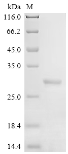 SDS-PAGE