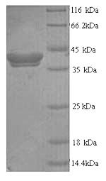SDS-PAGE