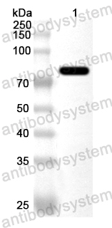 Валидация AntibodySystem PXX21101