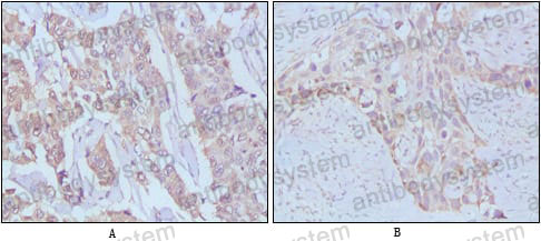 Валидация AntibodySystem RHB91401 (449)