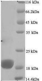 SDS-PAGE