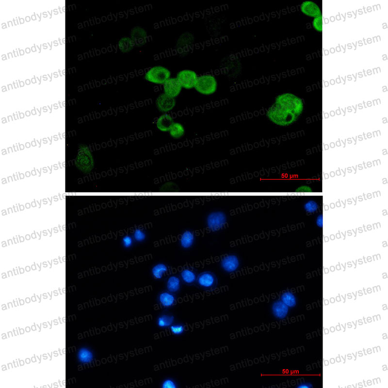 Валидация AntibodySystem RHD83201