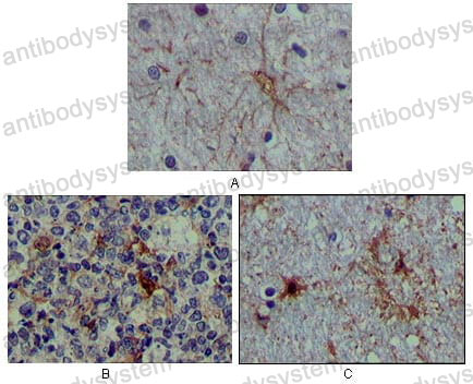 Валидация AntibodySystem RHD56601