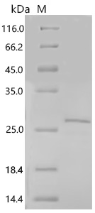 SDS-PAGE