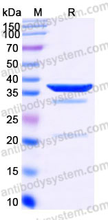 YHD07702, SDS-PAGE
