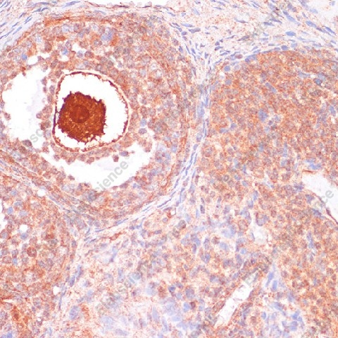Иммуногистохимия, CDC20, ткань яичника крысы