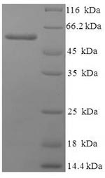 SDS-PAGE