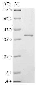 SDS-PAGE