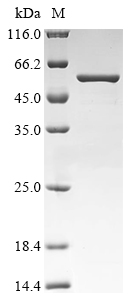 SDS-PAGE