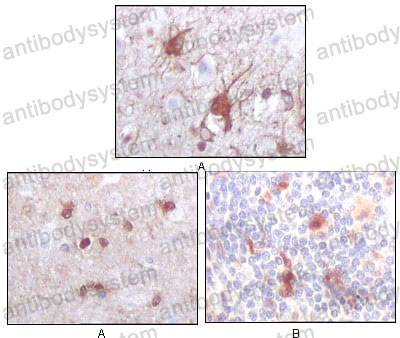Валидация AntibodySystem RHC08406 (605)