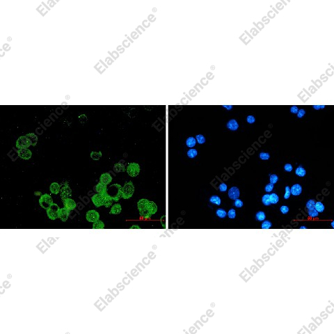 Иммунофлуоресценция, Estrogen Receptor alpha, клетки MCF-7