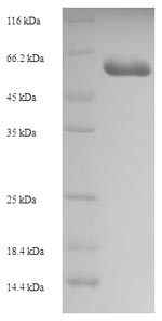 SDS-PAGE