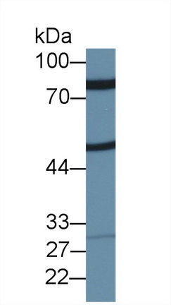9951