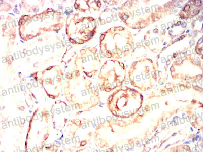 Валидация AntibodySystem RHH16101 (3194)