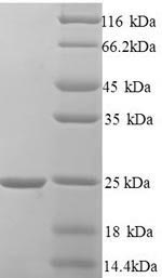 SDS-PAGE