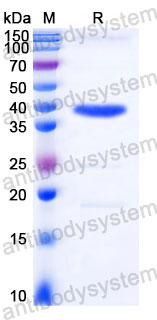 YHC40702, SDS-PAGE
