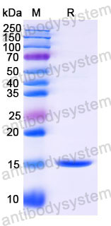 Валидация SDS-PAGE - AntibodySystem RHJ85001