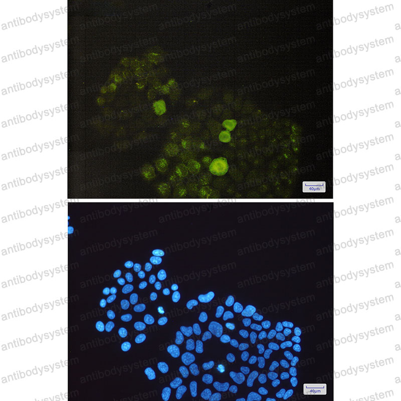 Валидация IF - AntibodySystem RHD27704