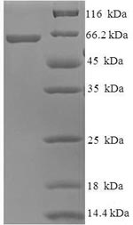 SDS-PAGE