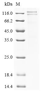 SDS-PAGE