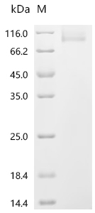 SDS-PAGE