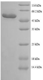 SDS-PAGE