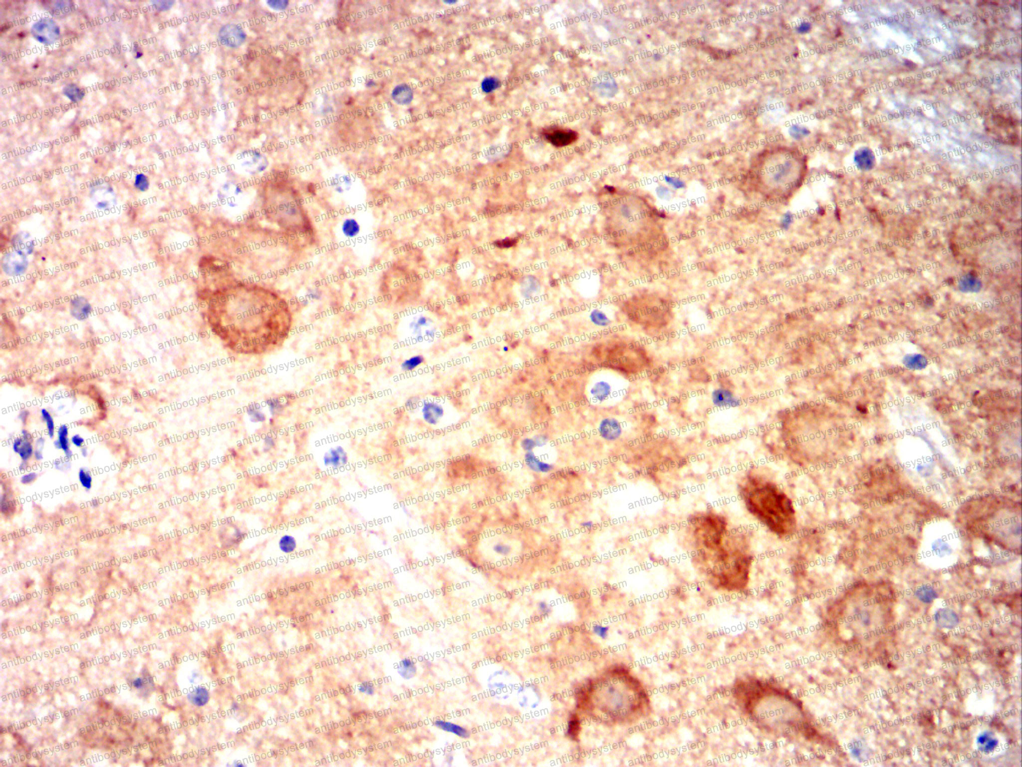 Валидация AntibodySystem RHG58404 (3016)