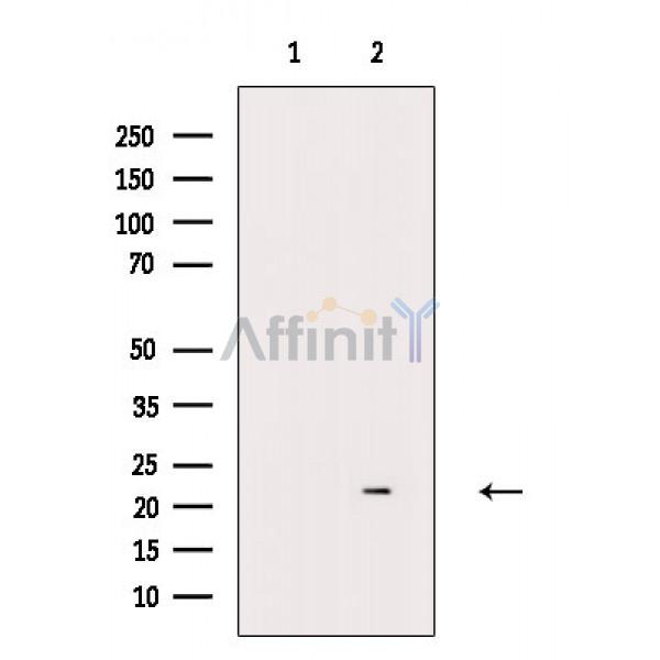 Валидация Affinity DF2375 - 12957