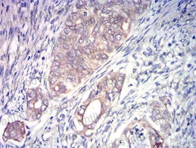Валидация AntibodySystem RHJ98302 (3603)