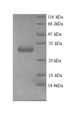 SDS-PAGE