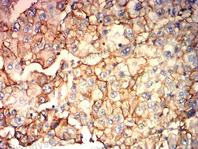 Валидация AntibodySystem RHM00304