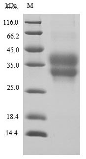 SDS-PAGE