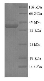 SDS-PAGE